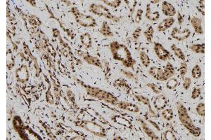 ABIN6272513 at 1/100 staining Human kidney tissue by IHC-P. (MAGEB6 抗体  (Internal Region))