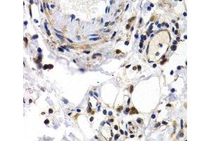 Immunohistochemistry of paraffin-embedded Human normal colon using PKLR Polyclonal Antibody at dilution of 1:200 (40x lens). (PKLR 抗体)