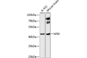 Western blot analysis of extracts of various cell lines, using NFIX antibody (ABIN6129696, ABIN6144568, ABIN6144569 and ABIN6224994) at 1:3000 dilution. (NFIX 抗体  (AA 180-260))