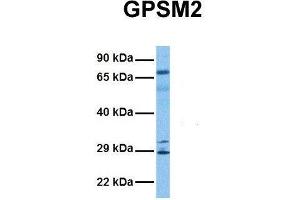 Host:  Rabbit  Target Name:  GPSM2  Sample Tissue:  Human Lung Tumor  Antibody Dilution:  1. (GPSM2 抗体  (N-Term))