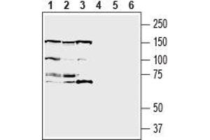 Western blot analysis of human  breast adenocarcinoma cell line lysate (lanes 1 and 4), human  MG glioblastoma cell line lysate (lanes 2 and 5) and human  monocytic leukemia cell line lysate (lanes 3 and 6):1-3. (Insulin-Like Growth Factor 1 Receptor (IGF1R) Peptide)