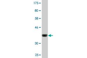 Western Blot detection against Immunogen (36. (PYGO1 抗体  (AA 101-200))