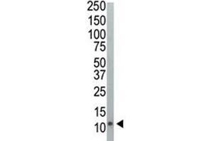 Western blot analysis of Ubiquitin antibody and HeLa cell lysate