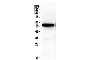 Western blot analysis of Syndecan-1/SDC1 using anti-Syndecan-1/SDC1 antibody . (Syndecan 1 抗体  (AA 23-254))