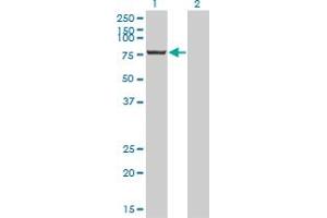 Western Blotting (WB) image for anti-Cleavage and Polyadenylation Specific Factor 3, 73kDa (CPSF3) (AA 585-684) antibody (ABIN565650)