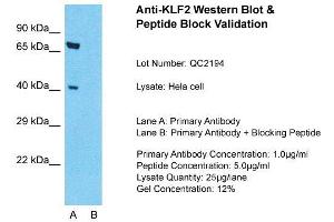 Host: Rabbit  Target Name: KLF2  Sample Tissue: Hela Whole cell  Lane A:  Primary Antibody Lane B:  Primary Antibody + Blocking Peptide Primary Antibody Concentration: 1 µg/mL Peptide Concentration: 5 µg/mL Lysate Quantity: 41 µg/laneGel Concentration:. (KLF2 抗体  (Middle Region))