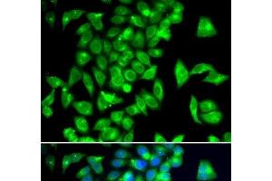 Immunofluorescence analysis of A549 cells using TPH2 Polyclonal Antibody (Tryptophan Hydroxylase 2 抗体)