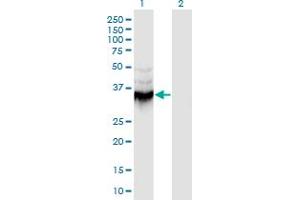 Western Blot analysis of ANXA9 expression in transfected 293T cell line by ANXA9 monoclonal antibody (M08), clone 5G3.