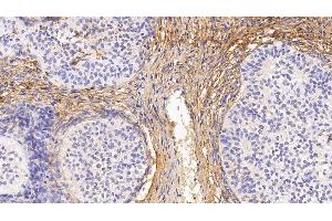 Detection of PIIINP in Human Ovary Tissue using Monoclonal Antibody to Procollagen III N-Terminal Propeptide (PIIINP) (PIIINP 抗体)