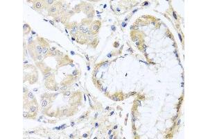 Immunohistochemistry of paraffin-embedded Human stomach using INPP5K Polyclonal Antibody at dilution of 1:100 (40x lens). (INPP5K 抗体)