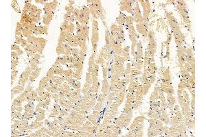 ABIN7094194 and ABIN7098240 at 1/100 staining rat heart tissue by IHC-P. (EHD3 抗体  (Internal Region))