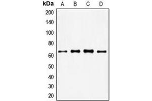 Western blot analysis of FOXO4 expression in HeLa (A), MM142 (B), HuT78 (C), NIH3T3 (D) whole cell lysates. (FOXO4 抗体  (Center))