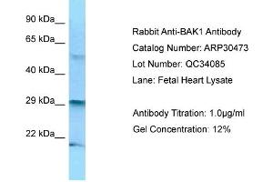 WB Suggested Anti-BAK1 Antibody   Titration: 1. (BAK1 抗体  (N-Term))
