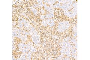 Immunohistochemistry (IHC) image for anti-ARHGDIB/D4-GDI/RhoGDI2 (AA 50-100) antibody (ABIN7453574) (ARHGDIB/D4-GDI/RhoGDI2 (AA 50-100) 抗体)