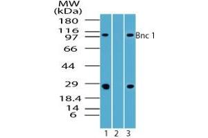 Image no. 1 for anti-Basonuclin 1 (BNC1) (AA 330-380) antibody (ABIN960100) (Basonuclin 1 抗体  (AA 330-380))