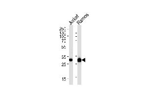 CASP3 Antibody (ABIN1882213 and ABIN2838477) western blot analysis in Jurkat,Ramos cell line lysates (35 μg/lane). (Caspase 3 抗体)