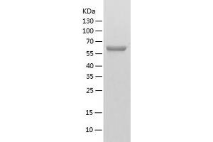Western Blotting (WB) image for alpha-Fetoprotein (AFP) (AA 19-605) protein (His tag) (ABIN7121801)