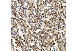 IHC analysis of TIMM29 using anti-TIMM29 antibody (ABIN7601495). (TIMM29 抗体  (AA 37-260))
