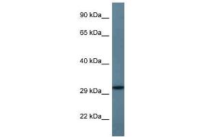 Western Blot showing STX11 antibody used at a concentration of 1 ug/ml against Fetal Heart Lysate (Syntaxin 11 抗体  (C-Term))