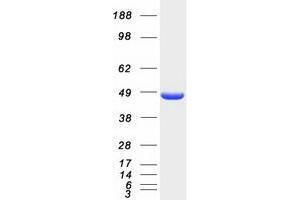 Western Blotting (WB) image for Hydroxymethylbilane Synthase (HMBS) (Transcript Variant 1) protein (Myc-DYKDDDDK Tag) (ABIN2722851)