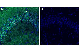 Free-floating frozen brain sections from a paraformaldehyde-perfused mouse were incubated with Anti-Endophilin-A1 antibody (ABIN7884928: 1:300), followed by goat anti-rabbit secondary antibody conjugated to Alexa Fluor® 488 (green). (SH3G2 抗体  (Intracellular))