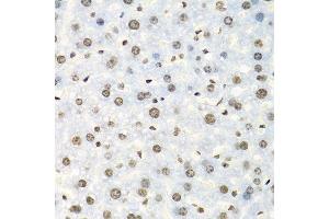 Immunohistochemistry of paraffin-embedded mouse liver using IGF2BP2 antibody. (IGF2BP2 抗体  (C-Term))