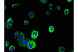 Immunofluorescent analysis of MCF-7 cells using ABIN7173027 at dilution of 1:100 and Alexa Fluor 488-congugated AffiniPure Goat Anti-Rabbit IgG(H+L) (TMEM19 抗体  (AA 34-83))