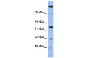 Image no. 1 for anti-Family with Sequence Similarity 178, Member B (FAM178B) (AA 607-656) antibody (ABIN6741667) (FAM178B 抗体  (AA 607-656))