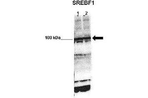 WB Suggested Anti-SREBF1 Antibody    Positive Control:  Lane 1: 50ug mouse glomerular endothelial lysate Lane 2: 50ug mouse glomerular endothelial lysate   Primary Antibody Dilution :   1:1000   Secondary Antibody :  Anti-rabbit-HRP   Secondry Antibody Dilution :   1:5000   Submitted by:  Xiaoxin Wang, UC Denver (SREBF1 抗体  (N-Term))