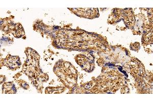 Detection of EGFR in Human Placenta Tissue using Monoclonal Antibody to Epidermal Growth Factor Receptor (EGFR) (EGFR 抗体  (AA 888-1210))