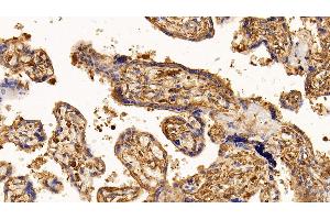 Detection of EGFR in Human Placenta Tissue using Monoclonal Antibody to Epidermal Growth Factor Receptor (EGFR)