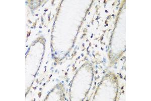 Immunohistochemistry of paraffin-embedded human stomach using EIF2B2 antibody at dilution of 1:200 (40x lens). (EIF2B2 抗体)