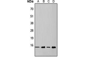Western blot analysis of 4EBP1 expression in HeLa (A), MCF7 (B), mouse kidney (C), rat liver (D) whole cell lysates. (eIF4EBP1 抗体  (Center))