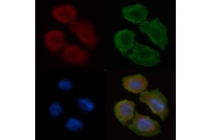 ABIN6258813 and ABIN6275138 staining Hela cells(30 min of UV treatment) by IF/ICC.