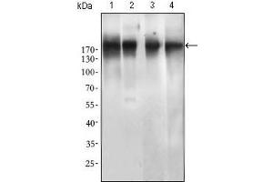 Western blot analysis using EGFR mutant mouse mAb against SPC-A-1 (1), A549 (2), HepG2 (3) and MCF-7 (4) cell lysate. (EGFR 抗体  (Mutant))