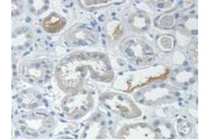 IHC-P analysis of Human Kidney Tissue, with DAB staining. (STAM2 抗体  (AA 1-377))