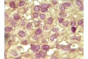 Immunohistochemistry (IHC) image for anti-Inhibin, alpha (INHA) (truncated) antibody (ABIN2464073) (Inhibin alpha 抗体  (truncated))