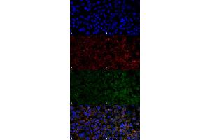 Immunocytochemistry/Immunofluorescence analysis using Mouse Anti-Hexanoyl-Lysine adduct Monoclonal Antibody, Clone 5E8 . (Hexanoyl-Lysine Adduct (HEL) 抗体 (Atto 594))