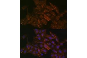 Immunofluorescence analysis of U2OS cells using KRAS+HRAS+NRAS Rabbit mAb (ABIN7267531) at dilution of 1:100 (40x lens). (GTPase NRas 抗体)