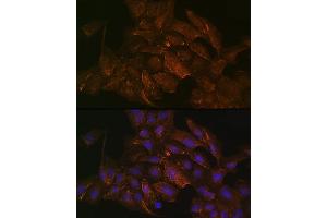 Immunofluorescence analysis of U2OS cells using KRAS+HRAS+NRAS Rabbit mAb (ABIN7267531) at dilution of 1:100 (40x lens). (GTPase NRas 抗体)