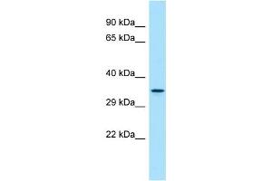 WB Suggested Anti-DUSP13 Antibody Titration: 1. (DUSP13 抗体  (N-Term))