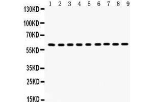 Anti- Hsp60 Picoband antibody, Western blotting All lanes: Anti Hsp60  at 0.