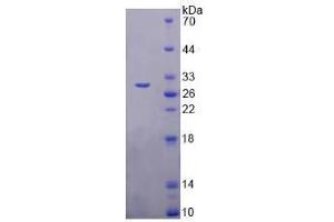 SDS-PAGE analysis of Human TMEM173 Protein. (STING/TMEM173 蛋白)