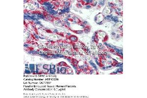 Immunohistochemistry (IHC) image for anti-G Protein-Coupled Receptor 6 (GPR6) (N-Term) antibody (ABIN2775307) (GPR6 抗体  (N-Term))