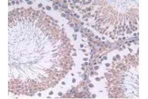 IHC-P analysis of Rat Testis Tissue, with DAB staining. (IL12A 抗体  (AA 23-215))