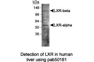 Image no. 1 for anti-Liver X Receptor (LXR) antibody (ABIN363490) (Liver X Receptor 抗体)