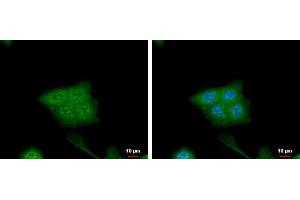 ICC/IF Image CRABP2 antibody [N1C3] detects CRABP2 protein at cytoplasm and nucleus by immunofluorescent analysis. (CRABP2 抗体)