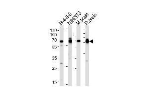 Western blot analysis of lysates from H-4-II-E, mouse NIH/3T3 cell line, mouse brain and rat brain tissues (from left to right), using STIP1 Antibody (C-term) (ABIN389319 and ABIN2839437). (STIP1 抗体  (C-Term))