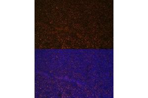 Immunofluorescence analysis of mouse spleen using CR2/CD21 Polyclonal Antibody (ABIN6132246, ABIN6138992, ABIN6138993 and ABIN6224458) at dilution of 1:100 (40x lens).