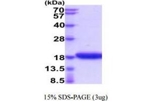 SDS-PAGE (SDS) image for Interleukin 17F (IL17F) (AA 31-163) protein (His tag) (ABIN6388046)